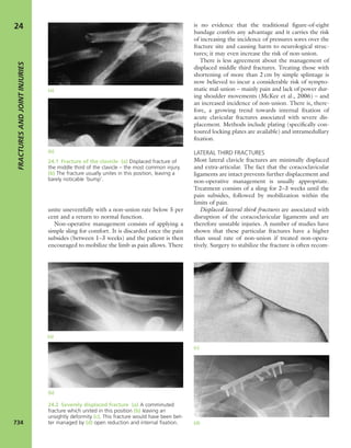 Apley's shoulderjt examination