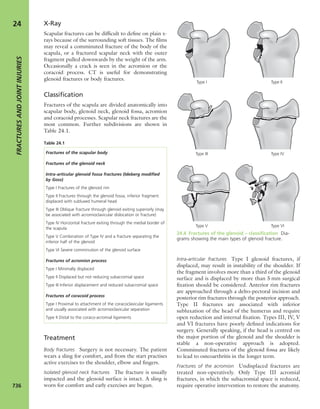 Apley's shoulderjt examination
