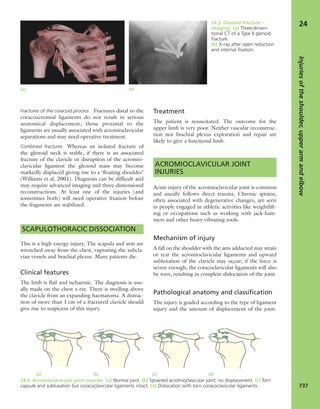 Apley's shoulderjt examination