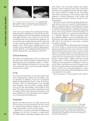 Apley's shoulderjt examination