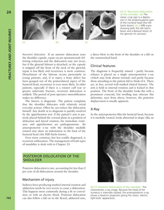 Apley's shoulderjt examination
