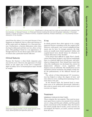 Apley's shoulderjt examination