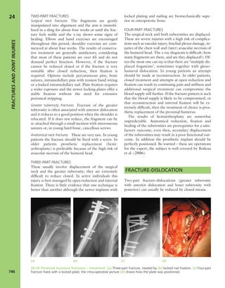 Apley's shoulderjt examination