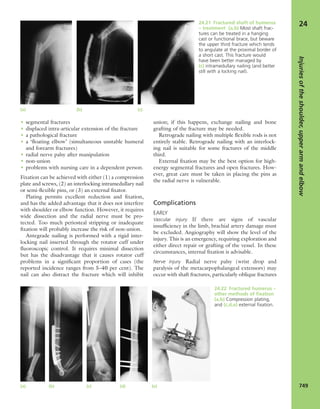 Apley's shoulderjt examination