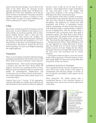 Apley's shoulderjt examination