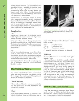 Apley's shoulderjt examination