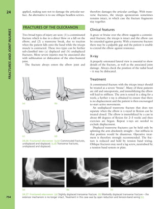 Apley's shoulderjt examination