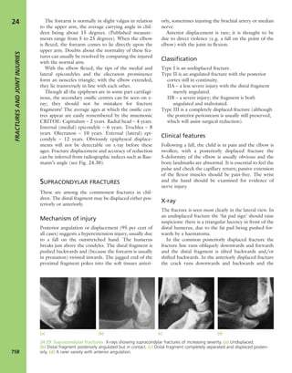 Apley's shoulderjt examination