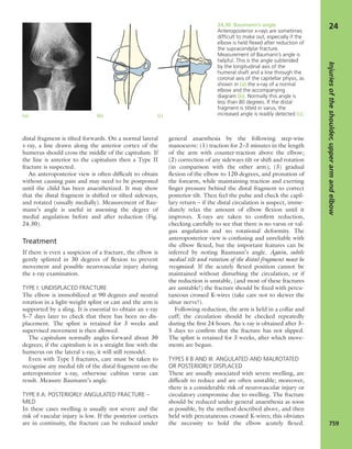 Apley's shoulderjt examination