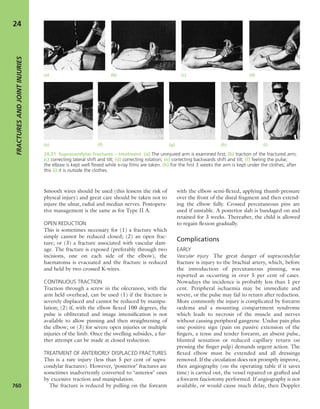 Apley's shoulderjt examination