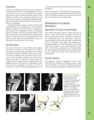 Apley's shoulderjt examination