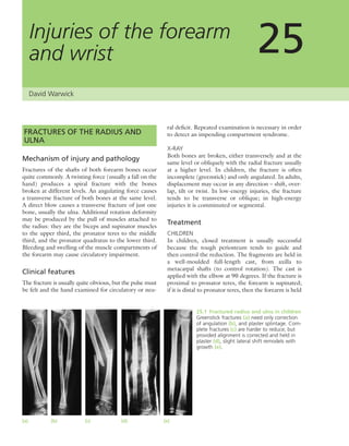 Apley's shoulderjt examination