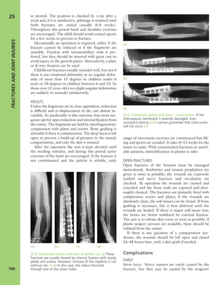 Apley's shoulderjt examination