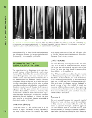 Apley's shoulderjt examination