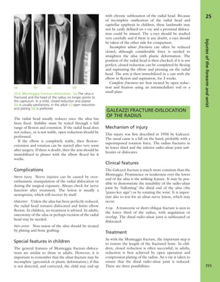 Apley's shoulderjt examination