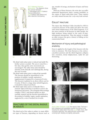 Apley's shoulderjt examination