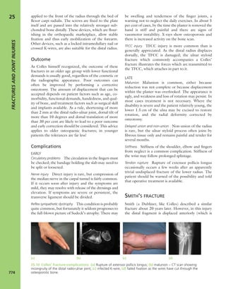Apley's shoulderjt examination