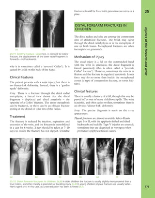 Apley's shoulderjt examination