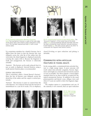 Apley's shoulderjt examination