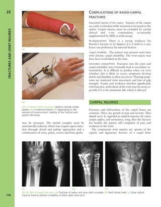 Apley's shoulderjt examination