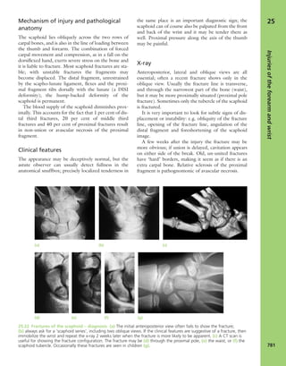 Apley's shoulderjt examination