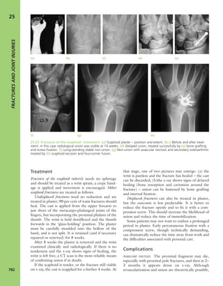 Apley's shoulderjt examination