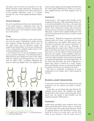 Apley's shoulderjt examination