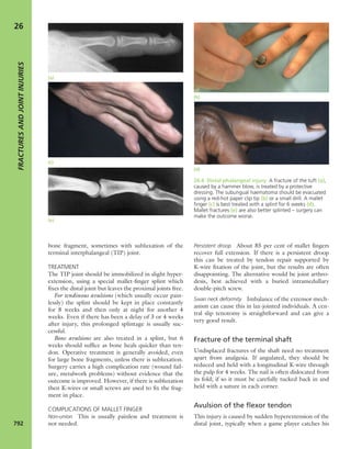 Apley's shoulderjt examination