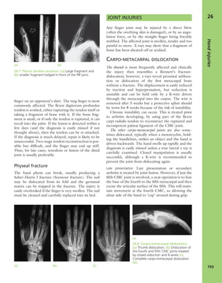 Apley's shoulderjt examination