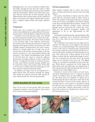 Apley's shoulderjt examination