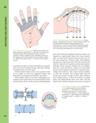 Apley's shoulderjt examination