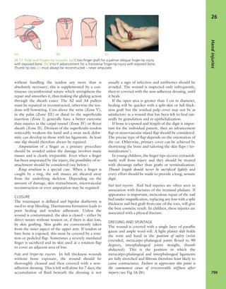 Apley's shoulderjt examination
