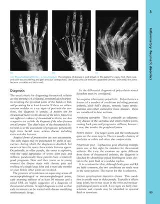 Diagnosis
The usual criteria for diagnosing rheumatoid arthritis
are the presence of a bilateral, symmetrical polyarthri-
tis involving the proximal joints of the hands or feet,
and persisting for at least 6 weeks. If there are subcu-
taneous nodules or x-ray signs of peri-articular ero-
sions, the diagnosis is certain. A positive test for
rheumatoid factor in the absence of the above features is
not sufﬁcient evidence of rheumatoid arthritis, nor does
a negative test exclude the diagnosis if the other features
are all present. The chief value of the rheumatoid fac-
tor tests is in the assessment of prognosis: persistently
high titres herald more serious disease including
extra-articular features.
Atypical forms of presentation are not uncommon.
The early stages may be punctuated by spells of qui-
escence, during which the diagnosis is doubted, but
sooner or later the more characteristic features appear.
Occasionally, in older people, the onset is explosive,
with the rapid appearance of severe joint pain and
stiffness; paradoxically these patients have a relatively
good prognosis. Now and then (more so in young
women) the disease starts with chronic pain and
swelling of a single large joint and it may take months
or years before other joints are involved.
The presence of tenderness on squeezing across all
metacarpophalangeal or metatarsophalangeal joints,
early morning stiffness of at least 30 minutes and a
raised ESR are highly suggestive of a diagnosis of
rheumatoid arthritis. A rapid diagnosis is vital so that
early treatment can be started with disease-modifying
antirheumatic drugs.
In the differential diagnosis of polyarthritis several
disorders must be considered.
Seronegative inﬂammatory polyarthritis Polyarthritis is a
feature of a number of conditions including psoriatic
arthritis, adult Still’s disease, systemic lupus erythe-
matosus and other connective-tissue diseases. These
are considered in later sections.
Ankylosing spondylitis This is primarily an inﬂamma-
tory disease of the sacroiliac and intervertebral joints,
causing back pain and progressive stiffness; however,
it may also involve the peripheral joints.
Reiter’s disease The larger joints and the lumbosacral
spine are the main targets. There is usually a history of
urethritis or colitis and often also conjunctivitis.
Polyarticular gout Tophaceous gout affecting multiple
joints can, at ﬁrst sight, be mistaken for rheumatoid
arthritis. On x-ray the erosions are quite different
from those of rheumatoid arthritis; the diagnosis is
clinched by identifying typical birefringent urate crys-
tals in the joint ﬂuid or a nodular tophus.
It is a curious fact that, although both gout and RA
are fairly common, the two conditions are rarely seen
in the same patient. The reason for this is unknown.
Calcium pyrophosphate deposition disease This condi-
tion is usually seen in older people. Typically it affects
large joints, but it may occur in the wrist and metacar-
pophalangeal joints as well. X-ray signs are fairly char-
acteristic and crystals may be identiﬁed in synovial
ﬂuid or synovium.
Inflammatoryrheumaticdisorders
63
3
(a) (b) (c)
3.4 Rheumatoid arthritis – x-ray changes The progress of disease is well shown in this patient’s x-rays. First, there was
only soft-tissue swelling and peri-articular osteoporosis; later juxta-articular erosions appeared (arrow); ultimately, the joints
became unstable and deformed.
 
