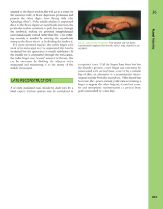 Apley's shoulderjt examination