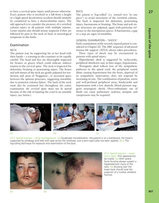 Apley's shoulderjt examination