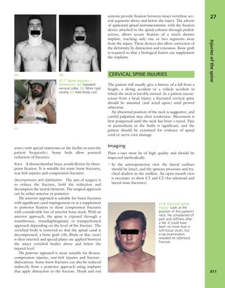 Apley's shoulderjt examination