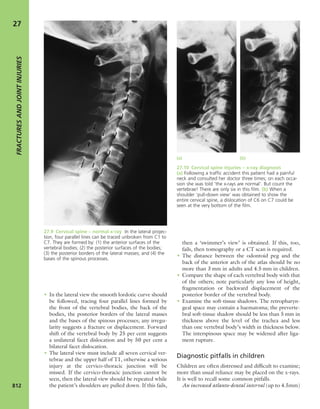 Apley's shoulderjt examination