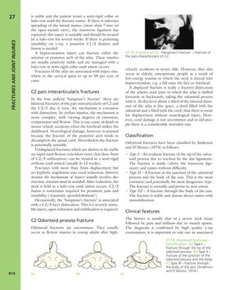 Apley's shoulderjt examination