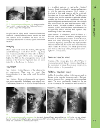 Apley's shoulderjt examination