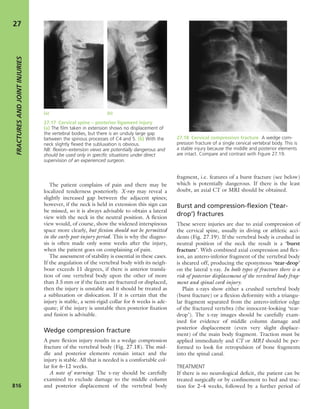 Apley's shoulderjt examination