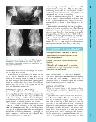 ment and priorities will vary according to the individ-
ual and stage of the disease.
At the onset of the disease both the patient and the
doctor will be uncertain about the likely rate of
progress. An attempt should be made to determine
the likely prognosis. Poor prognosis is associated with
female sex, multiple joint involvement, high ESR and
CRP, positive RF and anti-CCP, younger age and the
presence of erosions at diagnosis.
PRINCIPLES OF MEDICAL MANAGEMENT
Treatment should be aimed at controlling inﬂamma-
tion as rapidly as possible. This is likely to require the
use of corticosteroids for their rapid onset (initially
oral doses of 30 mg of prednisolone or 120 mg i.m.
methylprednisolone may be used). Steroids should be
rapidly tapered to prevent signiﬁcant side effects.
In addition, disease-modifying antirheumatic drugs
(DMARDs) should be started at this time. The ﬁrst
choice is now methotrexate at doses of 10–25 mg/week.
This may be used initially alone or in combination with
sulfasalazine and hydroxychloroquine. Leﬂunomide can
also be considered if methotrexate is not tolerated. Gold
and penicillamine are now used rarely.
Control of pain and stiffness with non-steroidal
anti-inﬂammatory drugs (NSAIDs) may be needed,
maintaining muscle tone and joint mobility by a bal-
anced programme of exercise, and general advice on
coping with the activities of daily living.
If there is no satisfactory response to DMARDs, it
is wise to progress rapidly to biological therapies such
as the TNF inhibitors inﬂiximab, etanercept and adal-
imumab (Scott & Kingsley, 2006; Deighton et al.,
2006).
Additional measures include the injection of long-
acting corticosteroid preparations into inﬂamed joints
and tendon sheaths. It is sometimes feared that such
injections may themselves cause damage to articular
cartilage or tendons. However, there is little evidence
that they are harmful, provided they are used spar-
ingly and with full precautions against infection.
Prolonged rest and immobility is likely to weaken
muscles and lead to a worse prognosis. However, some
splinting can be helpful at any stage of the disease.
PHYSIOTHERAPY AND OCCUPATIONAL THERAPY
Preventative splinting and orthotic devices may delay
the march of events; however, it is important to
encourage activity. If these fail to restore and maintain
function, operative treatment is indicated.
SURGICAL MANAGEMENT
At ﬁrst this consists mainly of soft-tissue procedures
(synovectomy, tendon repair or replacement and joint
stabilization); in some cases osteotomy may be more
appropriate.
In late rheumatoid disease, severe joint destruction,
ﬁxed deformity and loss of function are clear indica-
tions for reconstructive surgery. Arthrodesis, osteo-
tomy and arthroplasty all have their place and are
considered in the appropriate chapters. However, it
should be recognized that patients who are no longer
suffering the pain of active synovitis and who are con-
tented with a limited pattern of life may not want or
need heroic surgery merely to improve their anatomy.
Careful assessment for occupational therapy, the pro-
vision of mechanical aids and adjustments to their
Inflammatoryrheumaticdisorders
65
3
(a)
(b)
3.6 Rheumatoid arthritis – aftermath After the acute
inﬂammatory phase has passed, the patient may be left
with features of secondary osteoarthritis, especially in the
hips (a) and the knees (b).
KEY ELEMENTS IN MEDICAL TREATMENT
Identify patients with RA as early as possible
Start disease-modifying antirheumatic drugs
(DMARDs) immediately
Consider combination therapy with multiple
DMARDs
If DMARDs fail, progress rapidly to biological
therapies such as the TNF inhibitors inﬂiximab,
etanercept and adalimumab
 