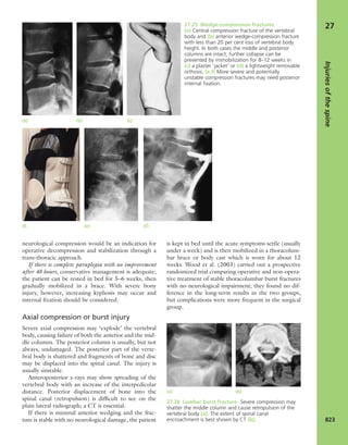 Apley's shoulderjt examination