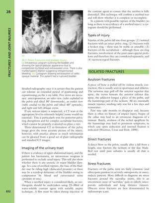 Apley's shoulderjt examination