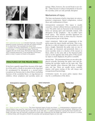 Apley's shoulderjt examination