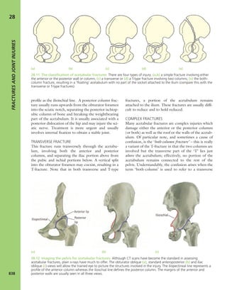 Apley's shoulderjt examination