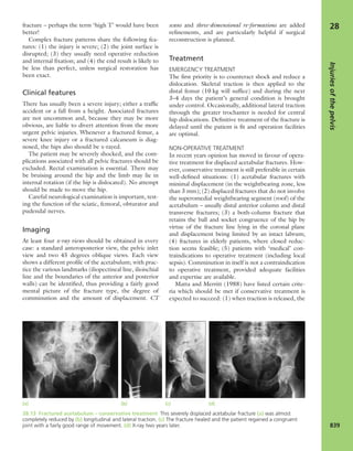 Apley's shoulderjt examination