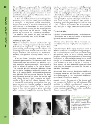 Apley's shoulderjt examination