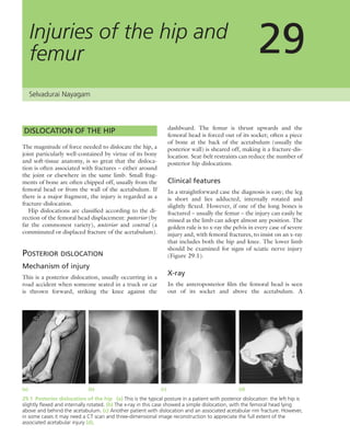 Apley's shoulderjt examination