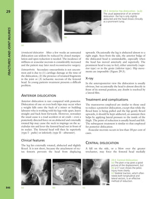 Apley's shoulderjt examination