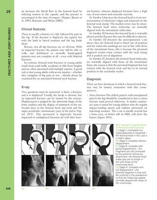 Apley's shoulderjt examination